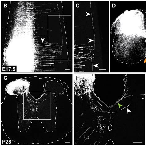 Neurons Of The Ptf1a Expressing Lineage Contribute To The Spinal DCN