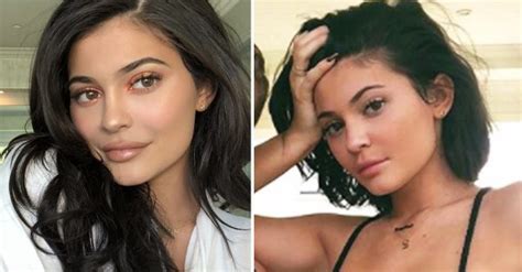 Is The Lip Filler Trend Over Expert Insight After Kylie Jenner Removes Fillers Ok Magazine