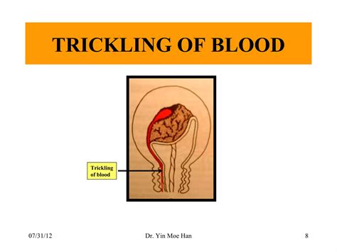 Normal labour, third stage by Dr Yin Moe | PPT