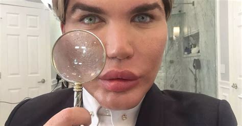 Human Ken Doll Rodrigo Alves Makes History As 51st Cosmetic Surgery