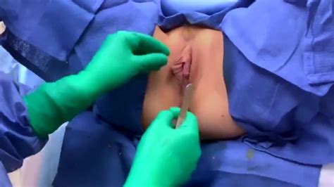 Sexy Surgeon Presents Labiaplasty Hoodoplasty Porn Videos