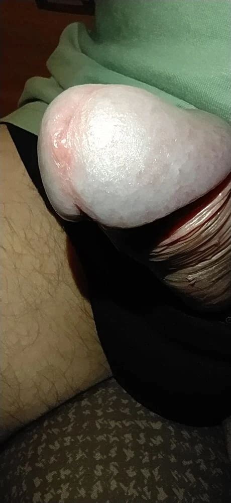 My Penis Is Swollen From The Blood Pulsing In It Nude Pics XHamster