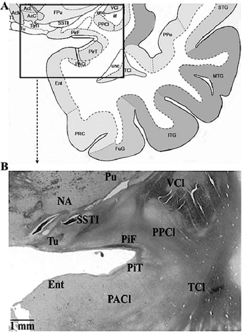 Piriform Cortex Anatomy