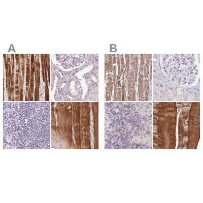 FAM168B Antibody NBP2 49343 Bio Techne