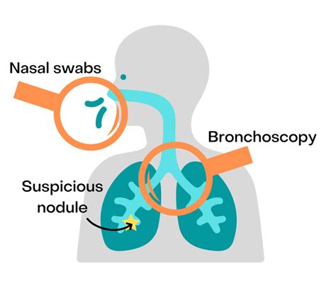 Identifying New Biomarkers To Detect Lung Cancer Earlier Division Of