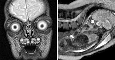 Ces images IRM de bébés dans lutérus terrifient les internautes