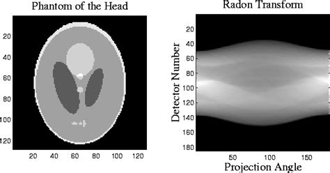 Preescolar Prisionero de guerra sentido the radon transform and medical ...
