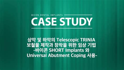 상악 및 하악의 Telescopic 보철물 제작과 장착 바이콘 SHORT Implants 와 Universal