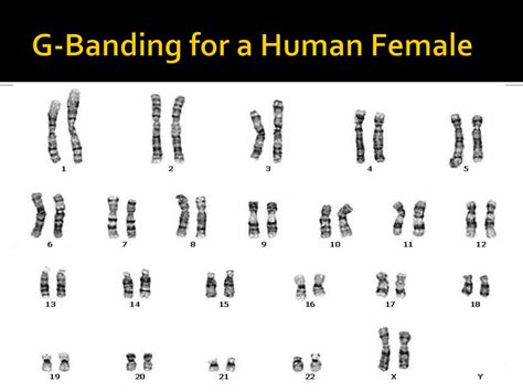 Ppt The Chromosomal Basis Of Inheritance Powerpoint Presentation Free Download Id 1931572