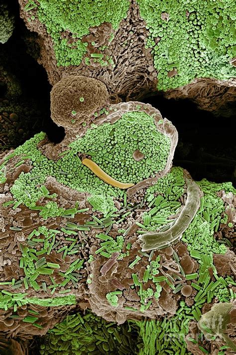 Life On The Surface Of Garden Soil Photograph By Dr Jeremy Burgess