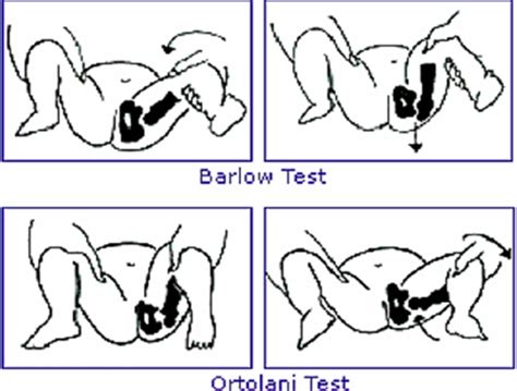 Pedi Musculoskeletal Abnormalities Flashcards Quizlet