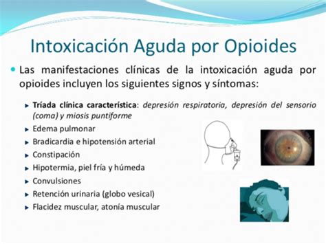 Intoxicaciones Pediatria Flashcards Quizlet