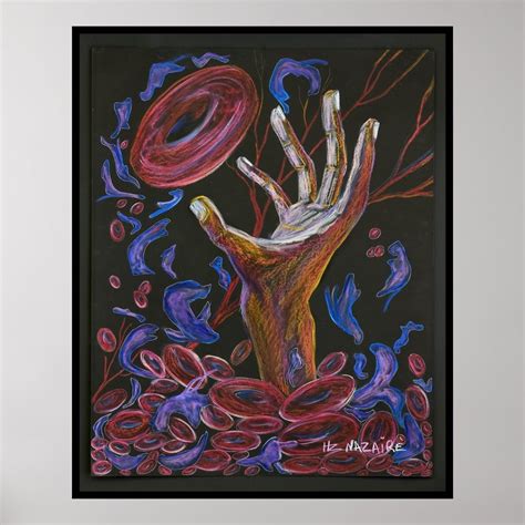 Hope Sickle Cell Art Print Zazzle