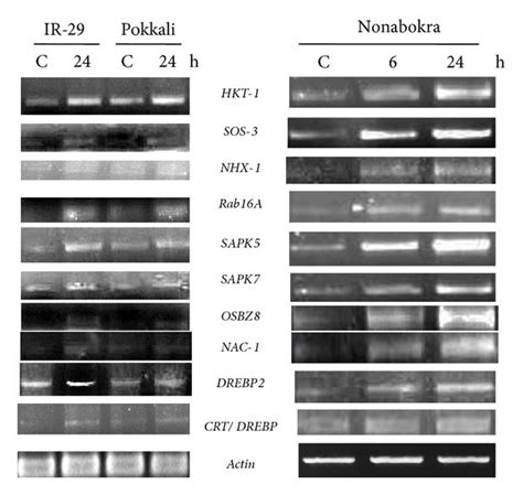 Semiquantitative Rt Pcr Analysis Showing Differential Gene Expression Download Scientific