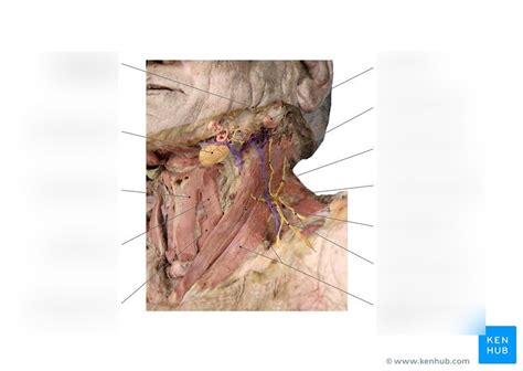 Gross Anatomy Lab Exam 2 Neck Muscles Cadaver Diagram Quizlet