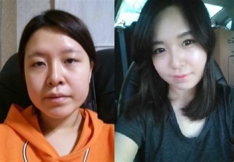 Crazy Before And After Photos Of South Korean Plastic Surgery Page 2