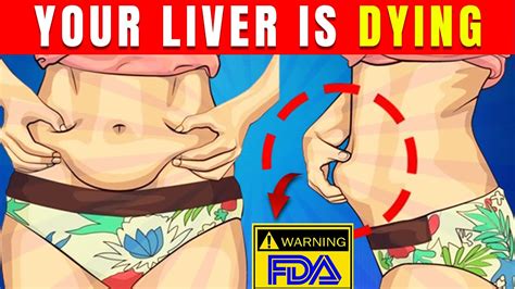 8 Silent Signs Of Fatty Liver Disease Symptoms Fda Warning