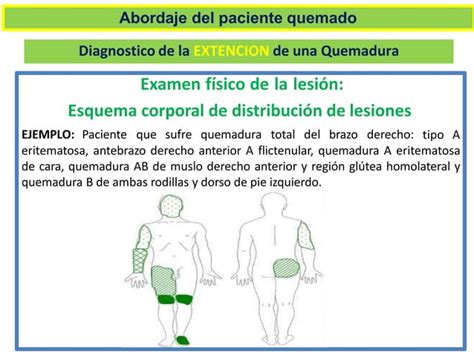 Tratamiento De Quemaduras Protocolo Pptx