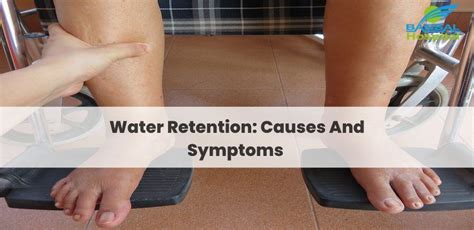 Water Retention Causes And Symptoms Bansal Hospital