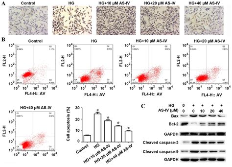 Astragaloside Iv Ameliorates High Glucoseinduced Hk Cell Apoptosis