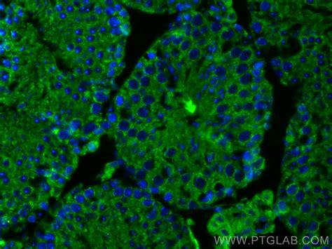 SMCR7L Antibody 67808 1 PBS Proteintech