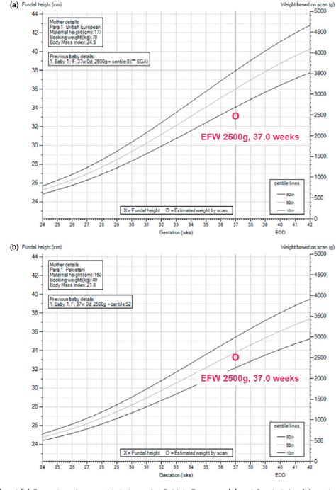 Fetal Weight Chart Uk