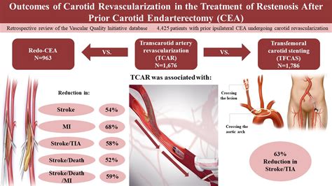 Outcomes Of Carotid Revascularization In The Treatment Of Restenosis