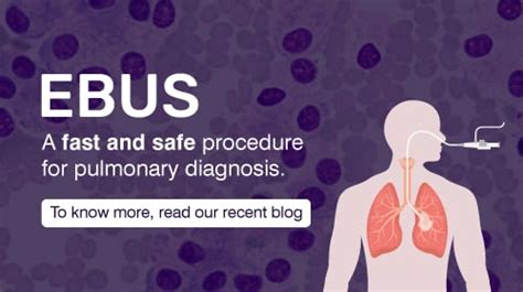 Endobronchial Ultrasound Bronchoscopy Ebus Procedure Rela Hospital