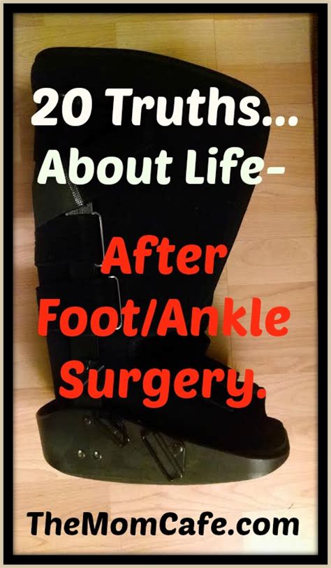 20 Truths About Life After Foot And Ankle Surgery For Those Who Need It