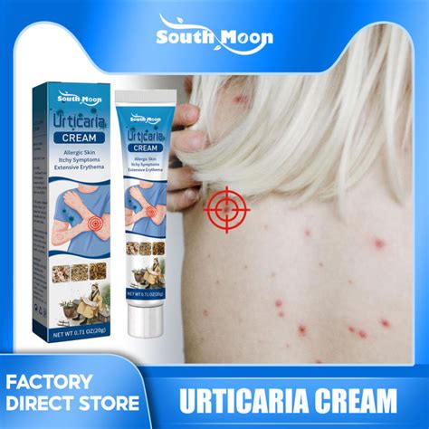 South Moon Urticaria Cream Psoriasis Antibacterial Cream Dermatitis