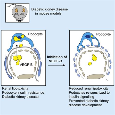 Reducing Vegf B Signaling Ameliorates Renal Lipotoxicity And Protects