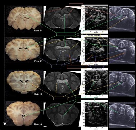 Coupes frontales d encéphale de brebis in vitro Comparaison entre a