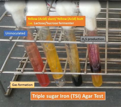 Triple Sugar Iron Agar Test Composition Principle Procedure Result