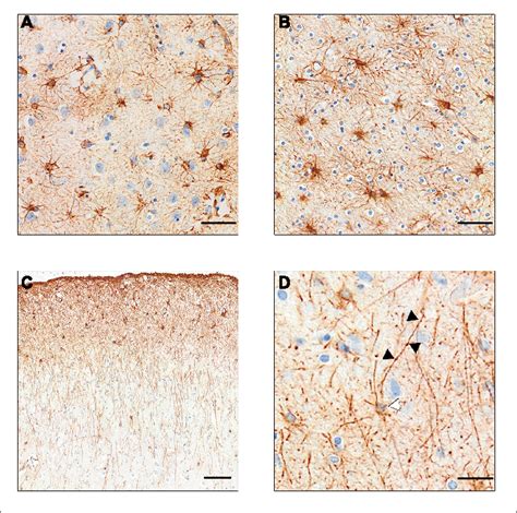 GFAP Stained Astrocyte Subtypes A Protoplasmic Astrocytes Of The