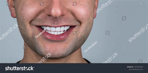 20 Unit Bq Veneers Stock Photo 1367974583 Shutterstock