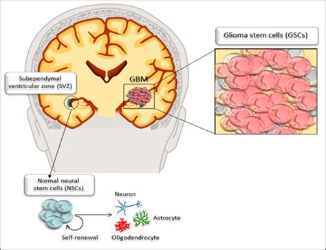 Novel Insights Into Genetic Approaches In Glioblastoma Multiforme