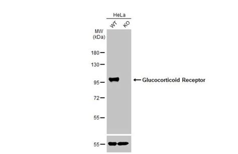 Glucocorticoid Receptor Nr C Monoclonal Antibody Hl