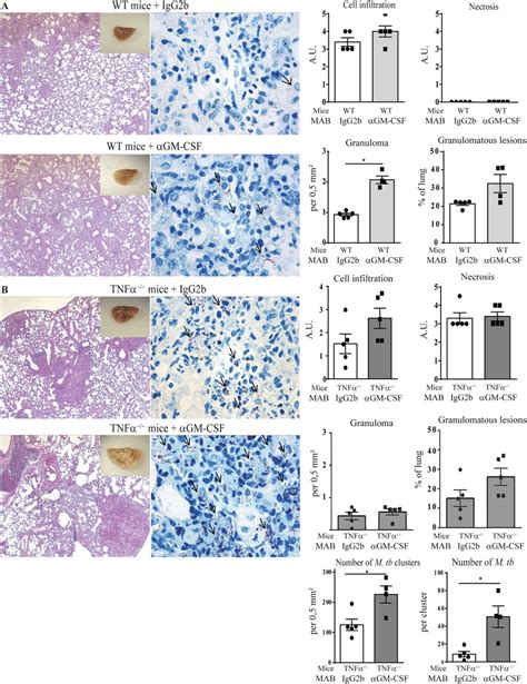 Effect Of Gm Csf Blockade On Granuloma Integrity And Bacterial Burden Download Scientific