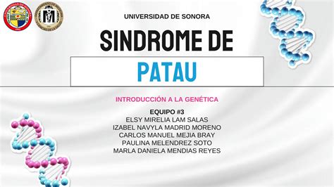 Solution Exposicion S Ndrome De Patau Introducci N A La Gen Tica