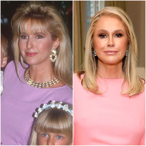 Has Kathy Hilton Gotten Plastic Surgery? See Her Transformation | Life