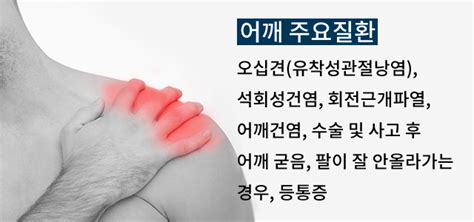 포항어깨통증회전근개석회화오십견 A17