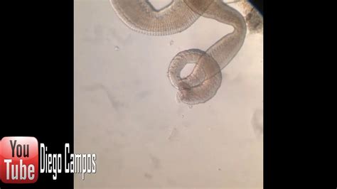 Hymenolepis Nana Adult Worm Youtube