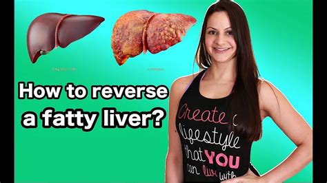 How To Reverse A Fatty Liver Nutritionist Giovana Guido Youtube