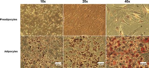 Oil Red O Staining In 3t3 L1 Preadipocytes And Adipocytes 3t3 L1 Cells