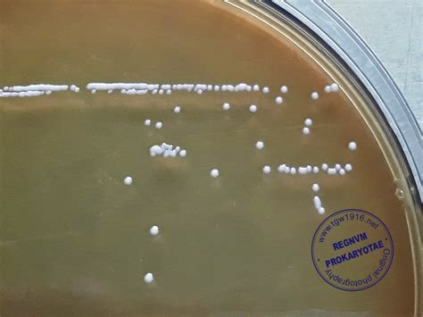 partido Republicano Comparación Lamer lactobacillus colony morphology Aspirar Agarrar Asser