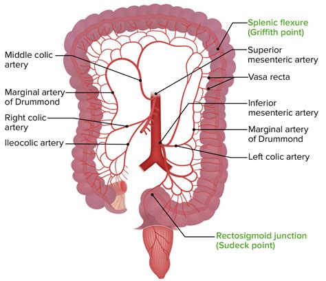 Mesenteric Ischemia | Concise Medical Knowledge