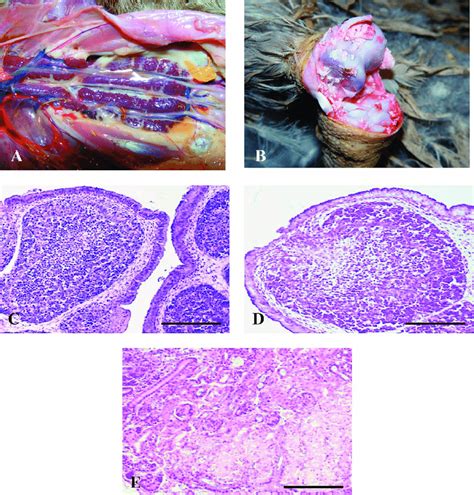 Gross And Microscopic Lesions In A 8 Week Old Gosling After Fatal