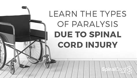 Types of Paralysis: Monoplegia, Hemiplegia, Paraplegia, and Quadriplegia