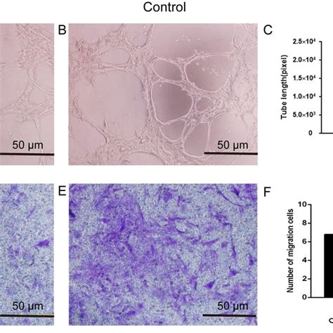 Angiogenic Activity Of BMECs A B Representative Images Of The Tube