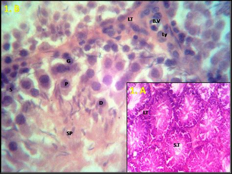 A Light Photomicrograph Of A Section In A Rat Testicular Tissue From